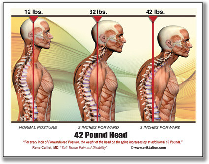 Stoðkerfismeðferð